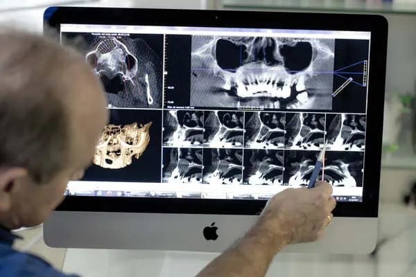 Odontólogo revisando estudios de tomografía dental en pantalla